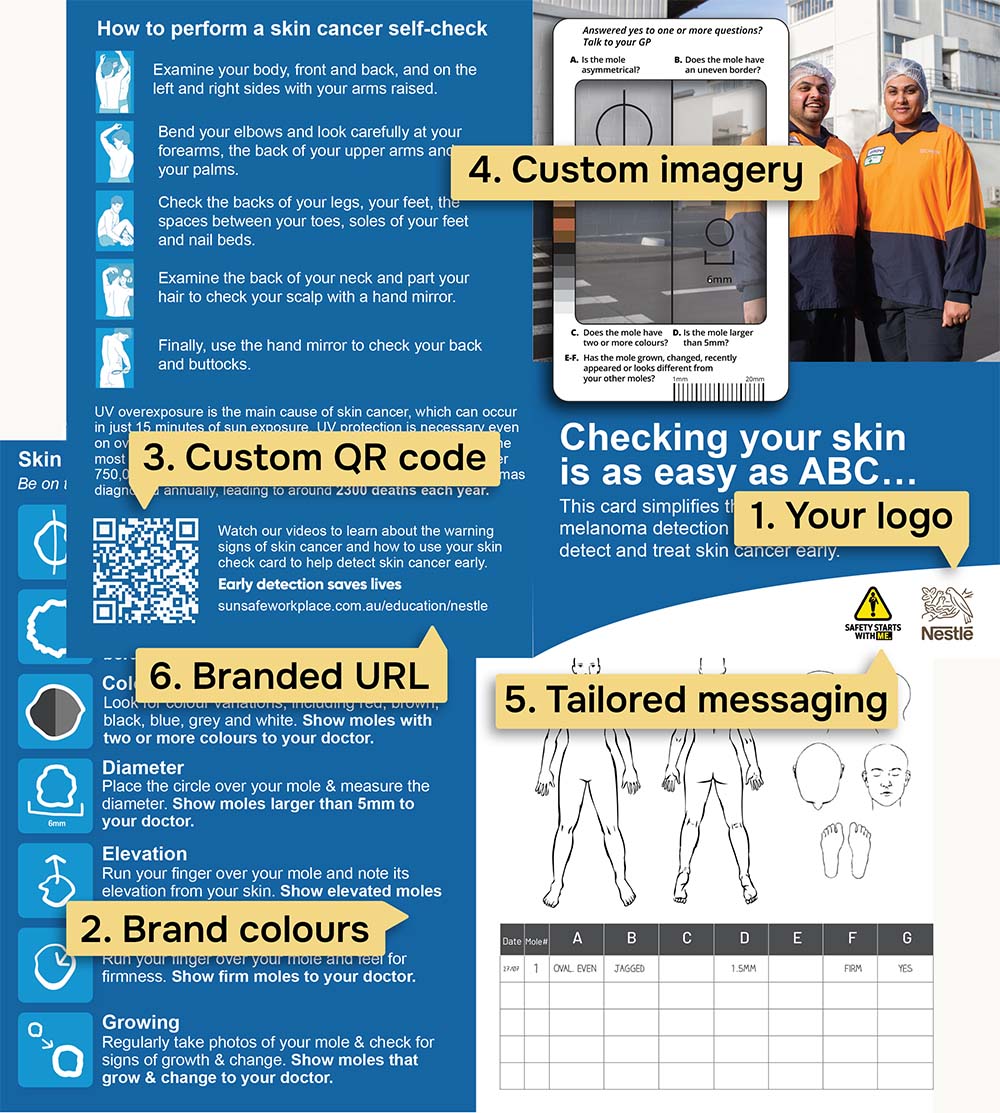 Custom branded Skin Check Cards